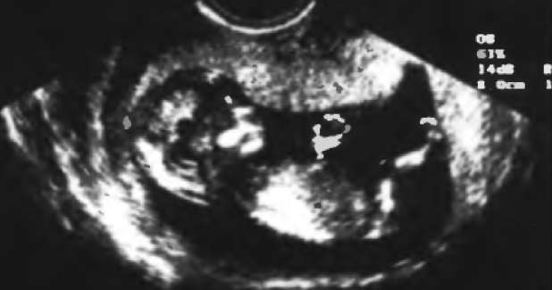 �������������� ����������� ����� �������� � ������������ ���������