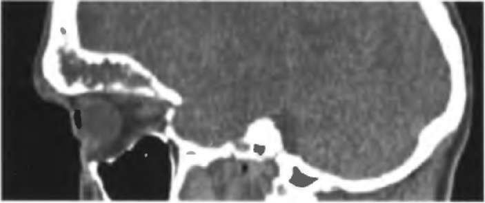 ��������-����������� ����������� ������ 