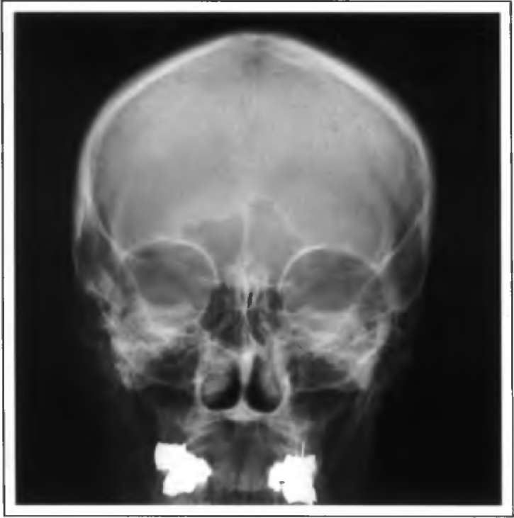 ������������� ����������� ������