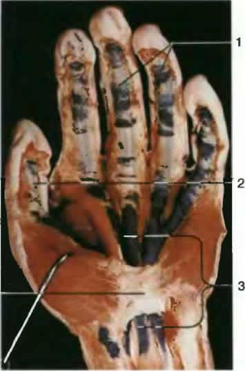 ��������� ������, ������������� ���������